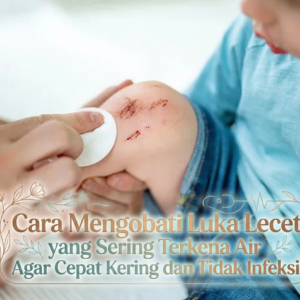 Cara Mengobati Luka Lecet yang Sering Terkena Air Agar Cepat Kering dan Tidak Infeksi