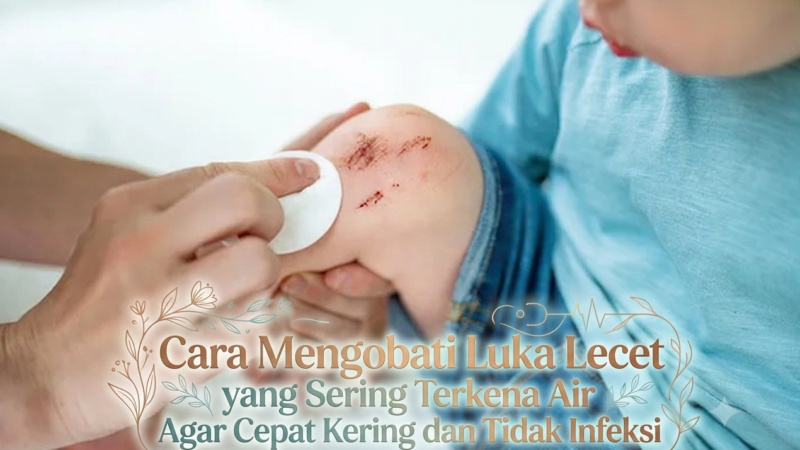 Cara Mengobati Luka Lecet yang Sering Terkena Air Agar Cepat Kering dan Tidak Infeksi